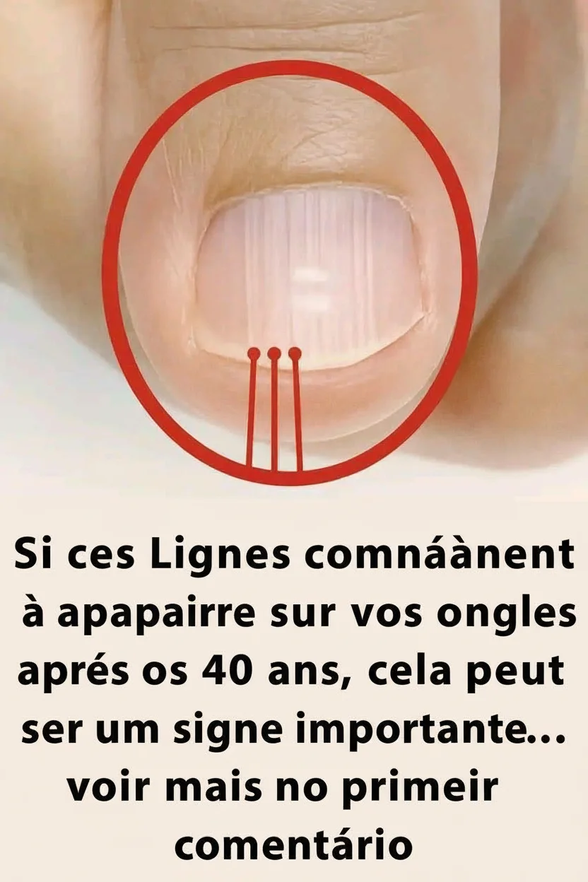 Si des lignes commencent à apparaître sur vos ongles après 40 ans, cela pourrait être un signe d'alerte…
