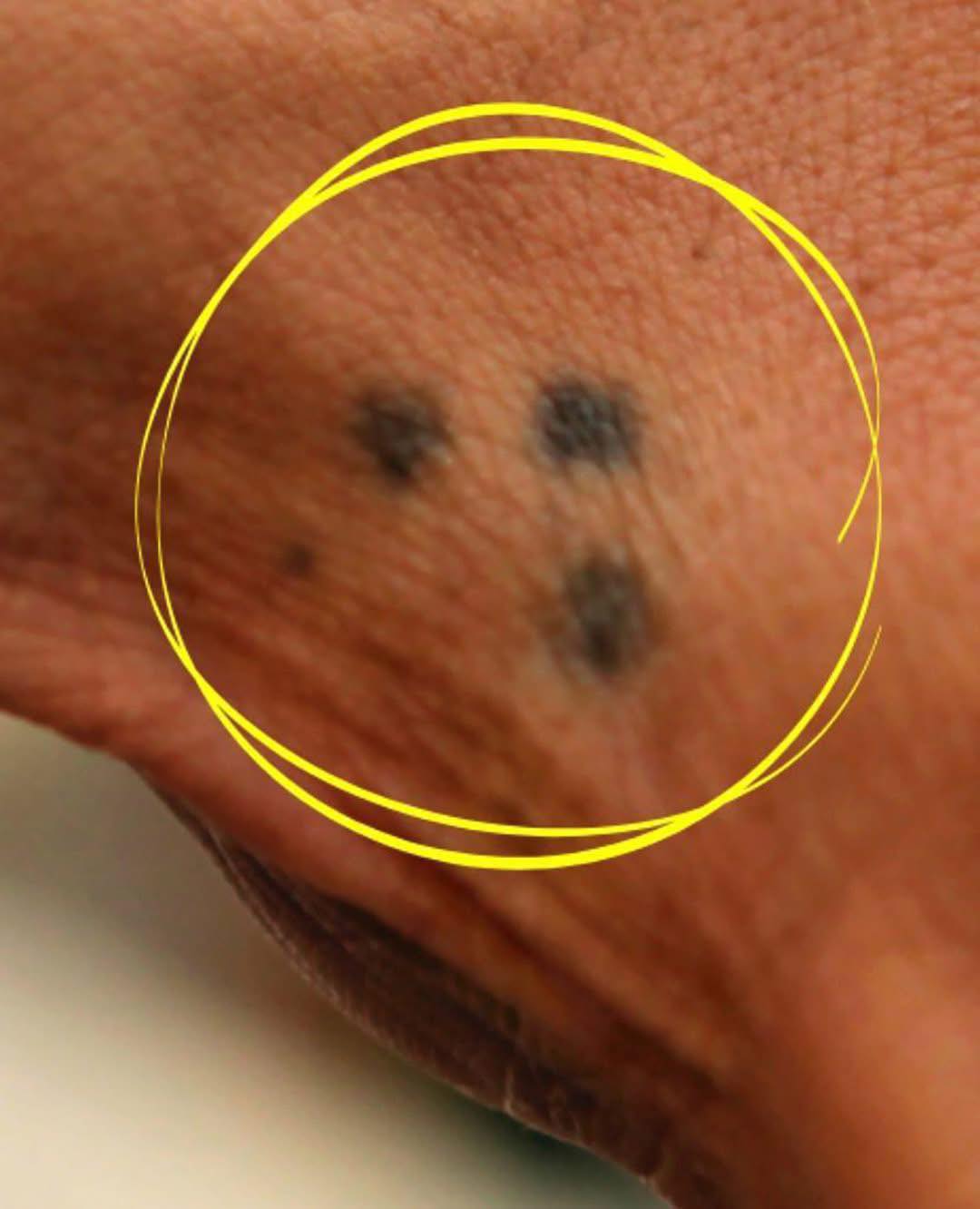 Si vous voyez un tatouage à trois points sur la main, méfiez-vous…