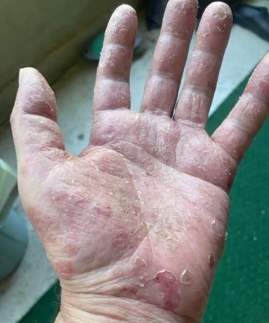 Attention à ces signes sur vos mains ! Pourquoi il ne faut jamais les ignorer